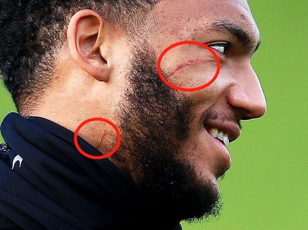 包含黄飞停赛影响无异归化国际队欧预赛惨败的词条